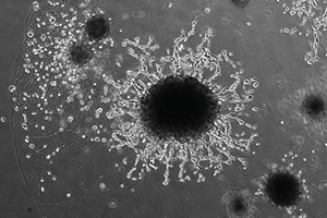 Placental organoid. Trophoblast cells are invading out of the organoid, mimicking placental cells invading the uterus in the early weeks of pregnancy.  Credit: Friedrich Miescher Institute/University of Cambridge