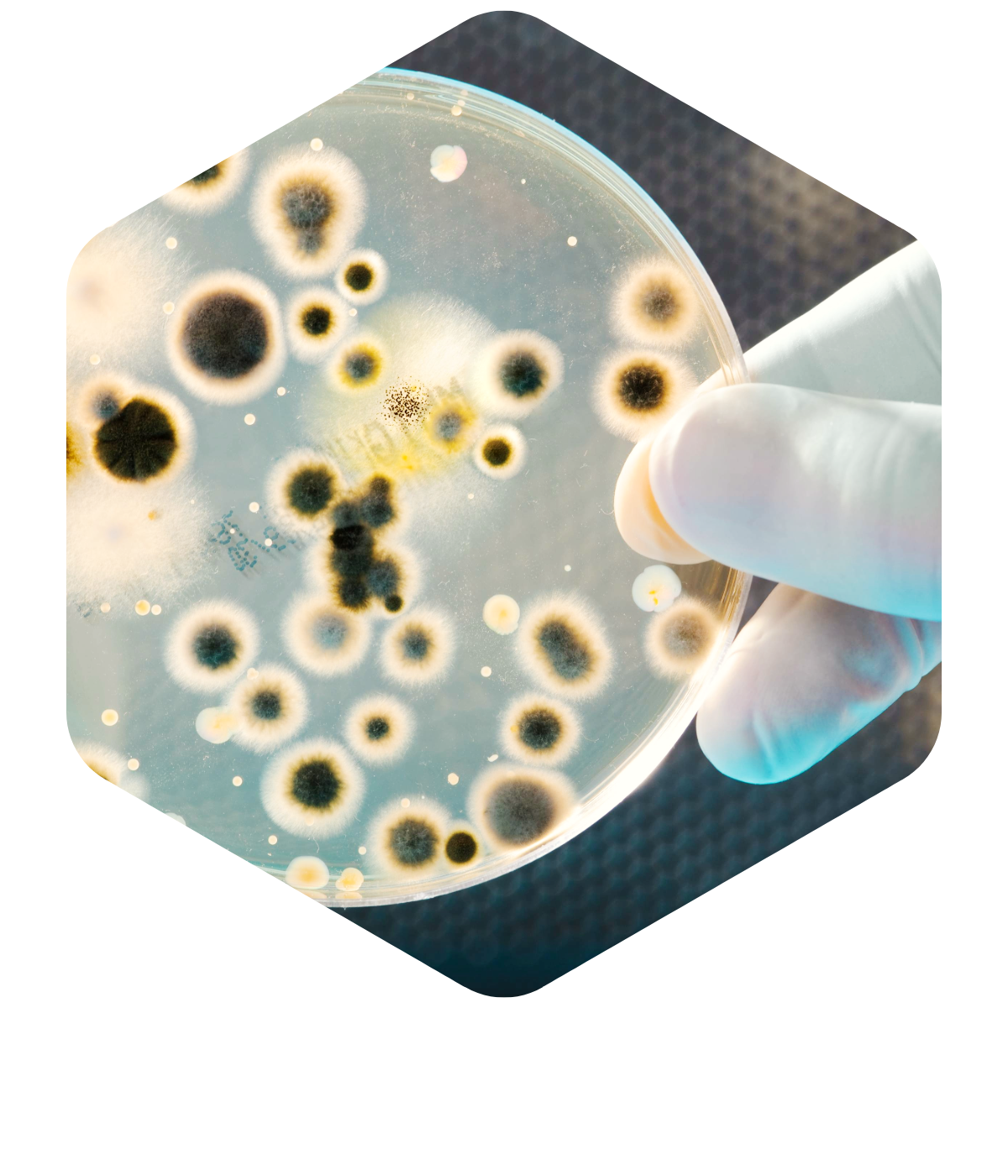 Bacteria culture. Credit: Alex Raths, iStock bacteria in petri dish. Credit: Alex Raths, iStock